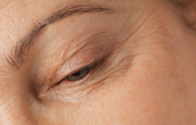 Гайд по морщинкам